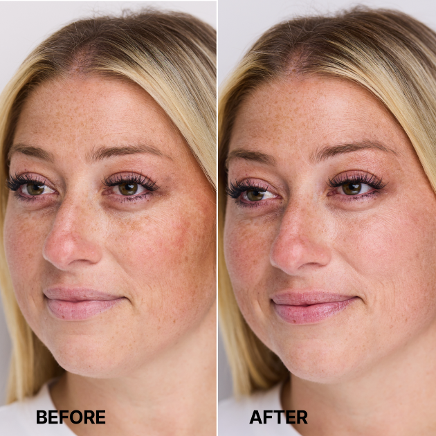 Chameleon Color Adaptor